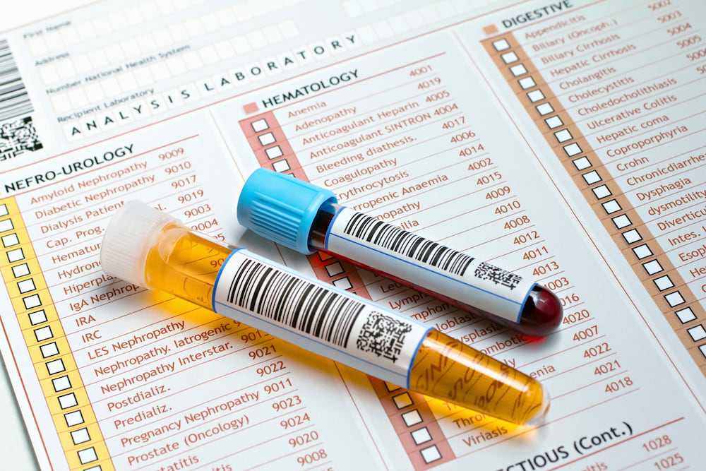 Diabetes & Cardiovascular Risk blood test