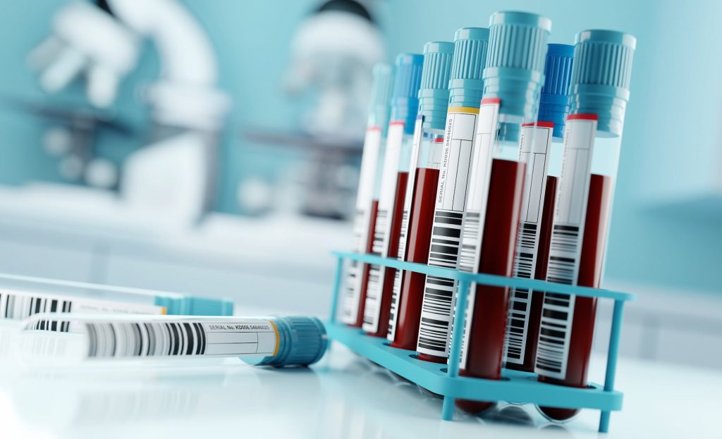 Iron Status blood test